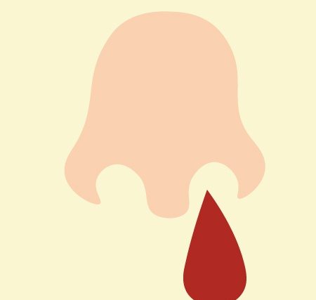 鼻血がよく出る子供の原因って何？効果的な止め方（止血方法）
